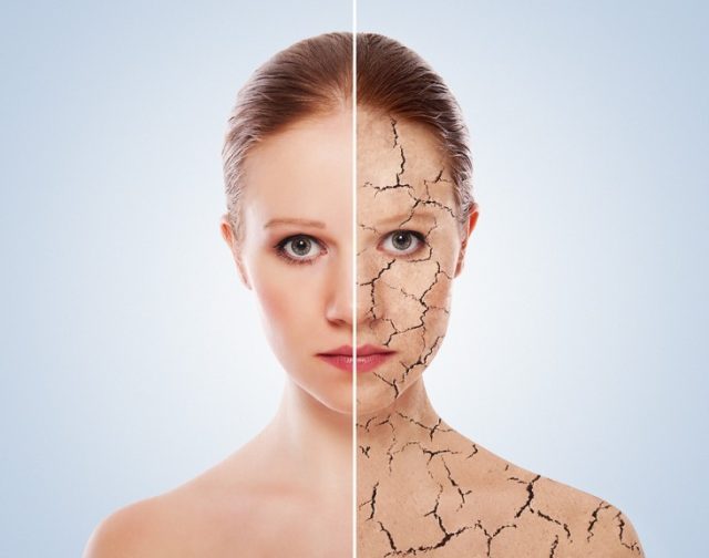 bigstock Concept Of Cosmetic Effects T 31983764 1 732x577